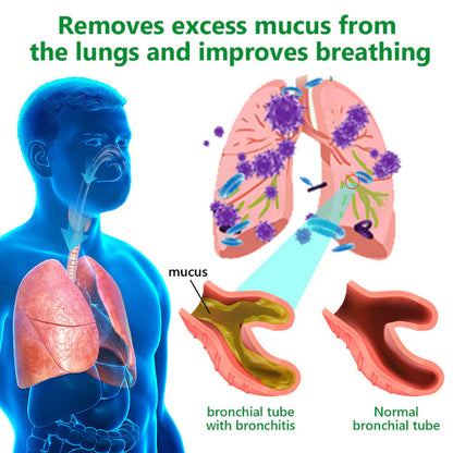 💖✅𝐂𝐀 𝐎𝐟𝐟𝐢𝐜𝐢𝐚𝐥 𝐒𝐭𝐨𝐫𝐞|𝐂𝐞𝐥𝐬𝐢𝐨𝐫𝐚® 𝐎𝐫𝐠𝐚𝐧𝐢𝐜 𝐌𝐮𝐥𝐥𝐞𝐢𝐧 𝐋𝐞𝐚𝐟 𝐋𝐮𝐧𝐠 𝐂𝐥𝐞𝐚𝐧𝐬𝐞 𝐄𝐬𝐬𝐞𝐧𝐭𝐢𝐚𝐥 𝐎𝐢𝐥 (🫁Cough, wheezing, shortness of breath, sputum, stuffy nose, bronchitis, bronchitis, allergy symptoms, lung discomfort💝)