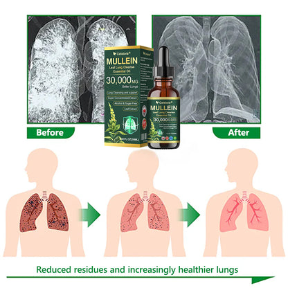 💖✅𝐂𝐀 𝐎𝐟𝐟𝐢𝐜𝐢𝐚𝐥 𝐒𝐭𝐨𝐫𝐞|𝐂𝐞𝐥𝐬𝐢𝐨𝐫𝐚® 𝐎𝐫𝐠𝐚𝐧𝐢𝐜 𝐌𝐮𝐥𝐥𝐞𝐢𝐧 𝐋𝐞𝐚𝐟 𝐋𝐮𝐧𝐠 𝐂𝐥𝐞𝐚𝐧𝐬𝐞 𝐄𝐬𝐬𝐞𝐧𝐭𝐢𝐚𝐥 𝐎𝐢𝐥 (🫁Cough, wheezing, shortness of breath, sputum, stuffy nose, bronchitis, bronchitis, allergy symptoms, lung discomfort💝)