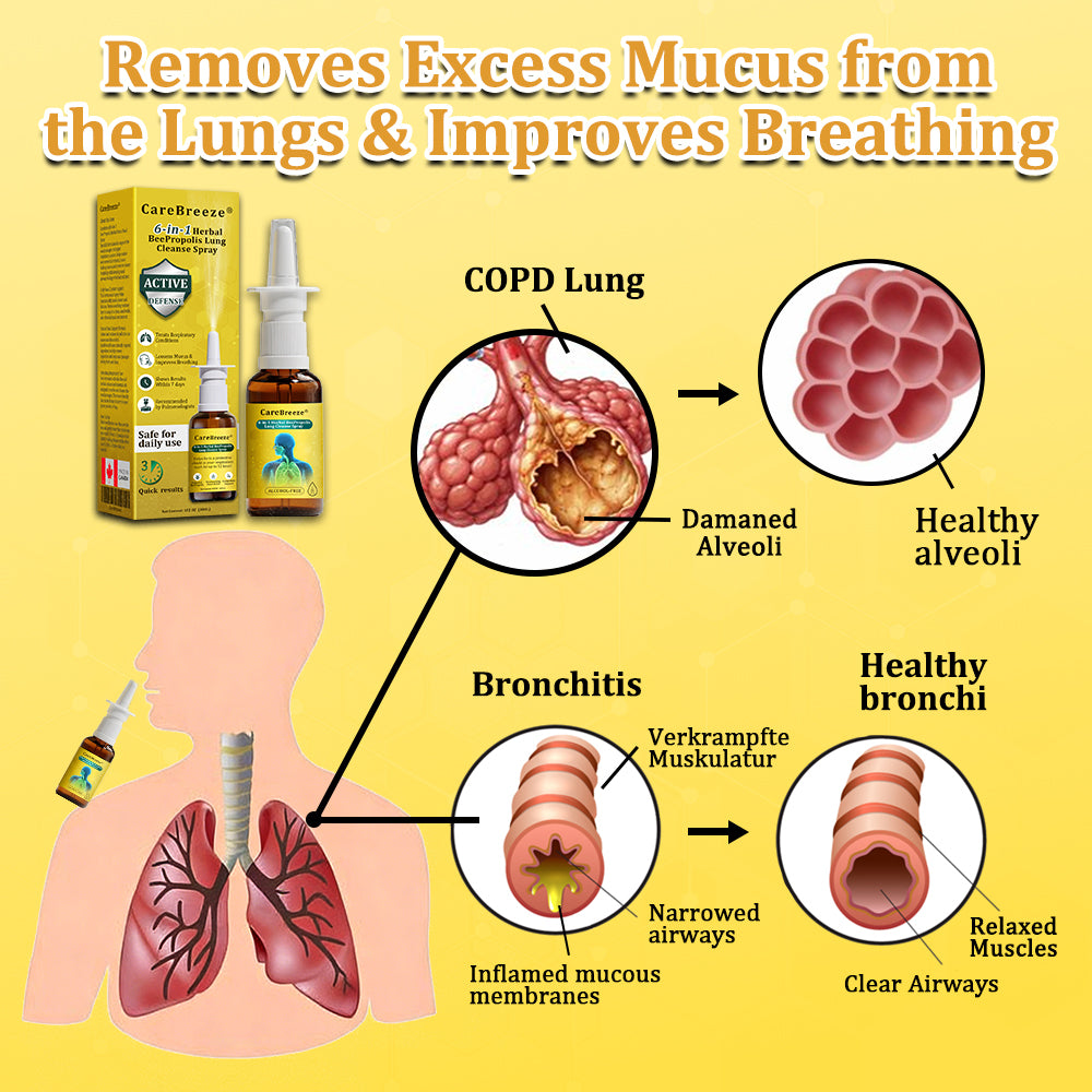 CA Official Store:CareBreeze® 6-in-1 Herbal BeePropolis Lung Cleanse Spray