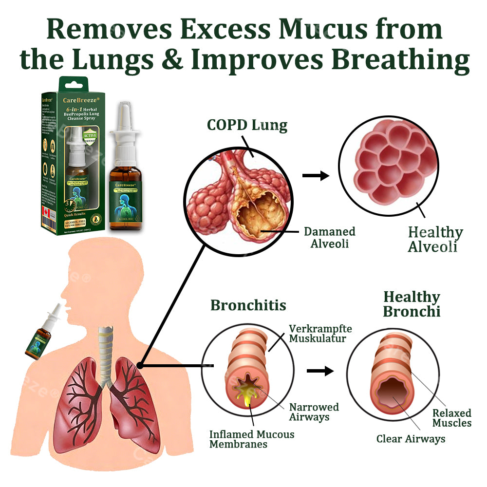 👨‍⚕️🇨🇦 Official Store:CareBreeze® 6-in-1 Herbal BeePropolis Lung Cleanse Spray🐝（👨‍⚕️Directly acts on COPD, asthma, chronic bronchitis (CB), respiratory infections, lung cancer, sinusitis, and other conditions）