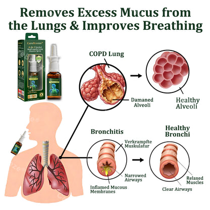 👨‍⚕️🇨🇦 Official Store:CareBreeze® 6-in-1 Herbal BeePropolis Lung Cleanse Spray🐝（👨‍⚕️Directly acts on COPD, asthma, chronic bronchitis (CB), respiratory infections, lung cancer, sinusitis, and other conditions）