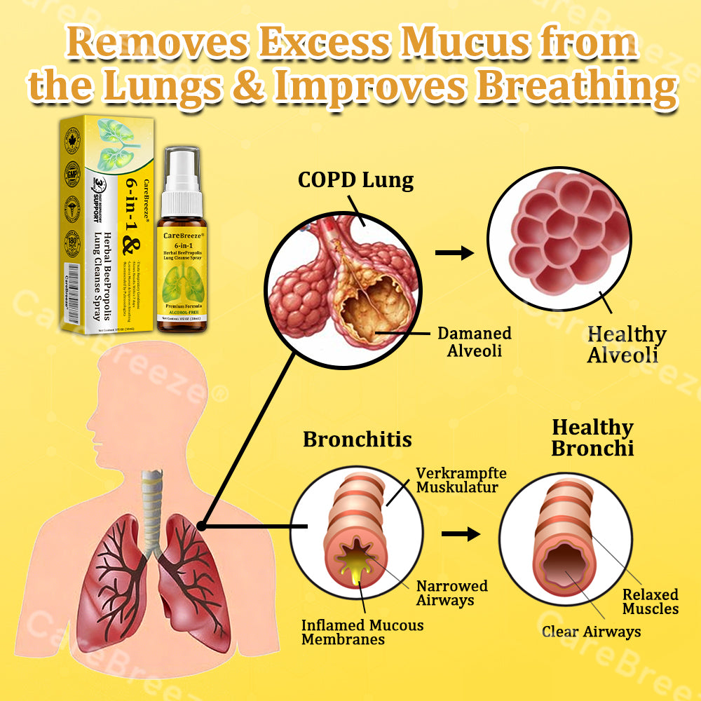 🐝✅🇨🇦 CareBreeze® 6-in-1 Herbal BeePropolis Lung Cleanse Spray