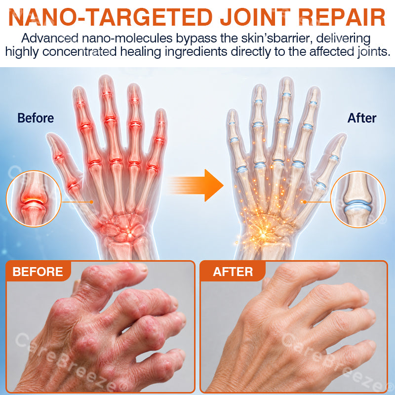 ✅🇨🇦 CareBreeze® Pain-Relief Bone-Healing Microneedle Patch(🧑‍⚕️Reducing joint swelling, pain, stiffness, redness, warmth, soreness, and joint fatigue)