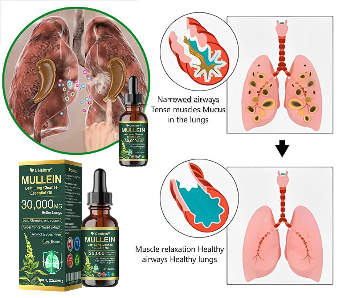 💖✅𝐂𝐀 𝐎𝐟𝐟𝐢𝐜𝐢𝐚𝐥 𝐒𝐭𝐨𝐫𝐞|𝐂𝐞𝐥𝐬𝐢𝐨𝐫𝐚® 𝐎𝐫𝐠𝐚𝐧𝐢𝐜 𝐌𝐮𝐥𝐥𝐞𝐢𝐧 𝐋𝐞𝐚𝐟 𝐋𝐮𝐧𝐠 𝐂𝐥𝐞𝐚𝐧𝐬𝐞 𝐄𝐬𝐬𝐞𝐧𝐭𝐢𝐚𝐥 𝐎𝐢𝐥 (🫁Cough, wheezing, shortness of breath, sputum, stuffy nose, bronchitis, bronchitis, allergy symptoms, lung discomfort💝)