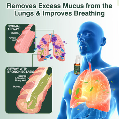🌻✅CA Official Store:CareBreeze® Botanical Mullein Leaf Extract Lung Cleanse Spray（👨‍⚕️Directly acts on COPD, asthma, chronic bronchitis (CB), respiratory infections, lung cancer, sinusitis, and other conditions）