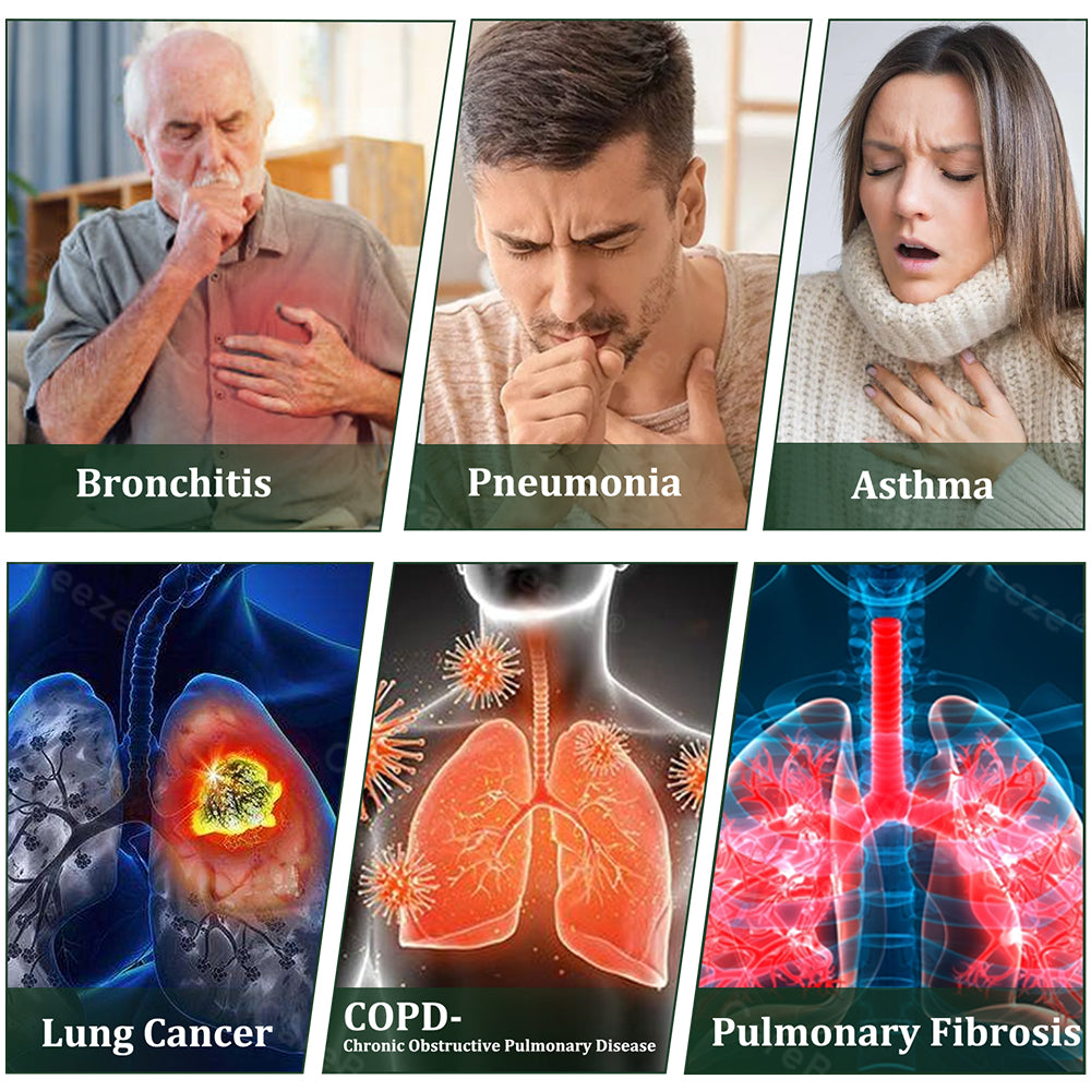 👨‍⚕️🇨🇦 Official Store:CareBreeze® 6-in-1 Herbal BeePropolis Lung Cleanse Spray🐝（👨‍⚕️Directly acts on COPD, asthma, chronic bronchitis (CB), respiratory infections, lung cancer, sinusitis, and other conditions）