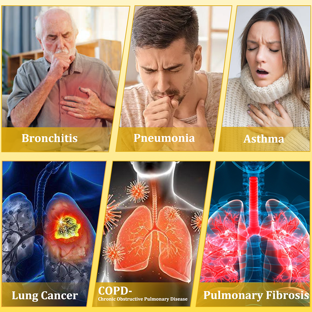 🐝✅CA Official Store:CareBreeze® 6-in-1 Herbal BeePropolis Lung Cleanse Spray（👨‍⚕️Directly acts on COPD, asthma, chronic bronchitis (CB), respiratory infections, lung cancer, sinusitis, and other conditions）